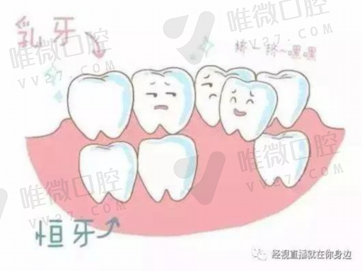 做了假牙冠和假牙的区别,牙冠是镶牙还是种牙(图1)